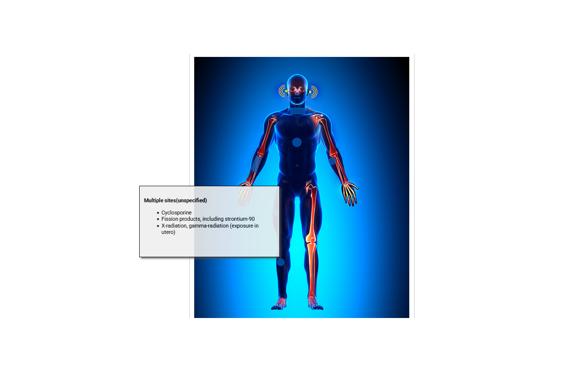 Cancer Causing Agents - Multiple Sites