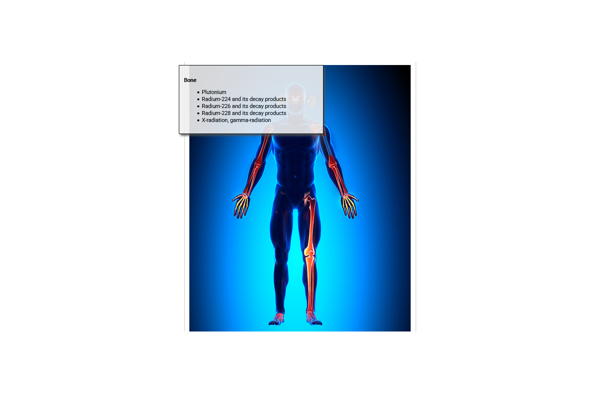 Cancer Causing Agents - Bone